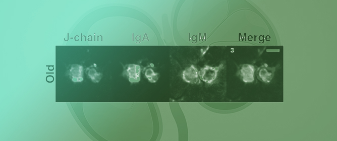 Plasma and Kidney Proteome Profiling Combined with Laser Capture Microdissection Reveal Large Increases in Immunoglobulins with Age