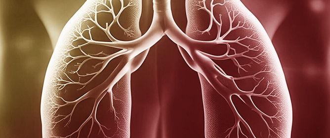 A Review of MDA-5 Dermatomyositis and Associated Interstitial Lung Disease