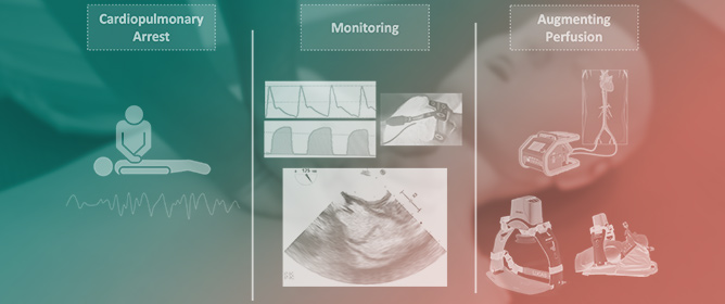 Physiology-Guided Resuscitation: Monitoring and Augmenting Perfusion during Cardiopulmonary Arrest