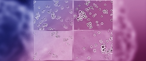 First Report of <em>Acanthamoeba</em> Genotype T4 from the Newly Formed Tajogaite Volcano Tephra (La Palma, Canary Islands)