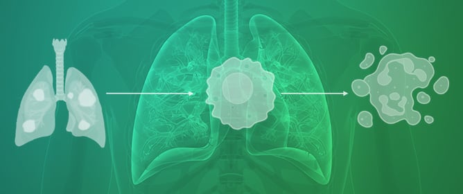 Understanding the Molecular Landscape of COPD to Progress Personalised Treatment