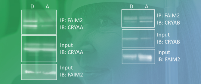 HSPB4/CRYAA Protect Photoreceptors during Retinal Detachment in Part through FAIM2 Regulation