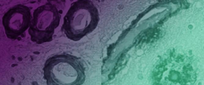 Novel Monoclonal Antibody Specific toward Amyloid-&beta; Binds to a Unique Epitope within the N-Terminal Region