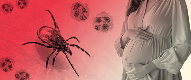 Tick-Borne Diseases and Pregnancy: A Narrative Review Evaluating Pregnancy Complications Caused by Tick-Borne Diseases