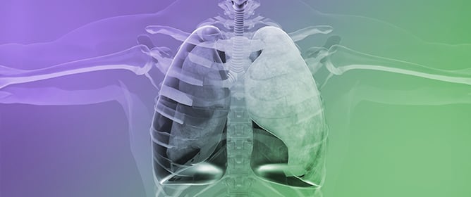 A Comprehensive Study of Reactive Oxygen Species Explicit Dosimetry for Pleural Photodynamic Therapy