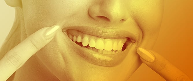 Evaluation of a New Technique of Gingival Smile Reduction after Hyaluronic Acid Infiltration: A Cohort Study Focusing on Gingival Exposure and Patient-Oriented Outcomes