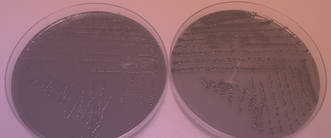 Molecular Patterns and AMR of Non-Typhoidal <em>Salmonella</em> in Humans, Food, and Environment in Luanda, Angola