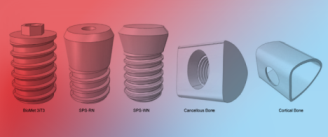 Osseointegration's Role in the Biomechanical Stability of Short Dental Implants: A Finite Element Study