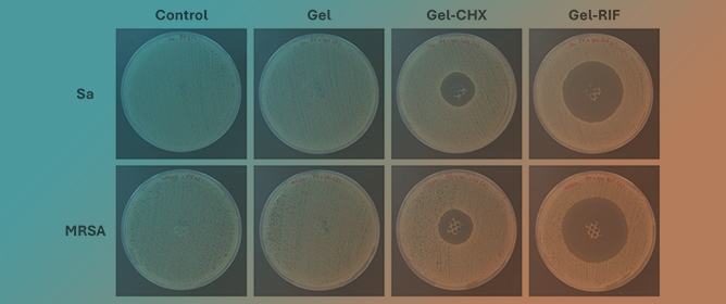 Potentiality of Antibacterial Gels for the Prophylactic Coating of Hernia Repair Prosthetic Materials