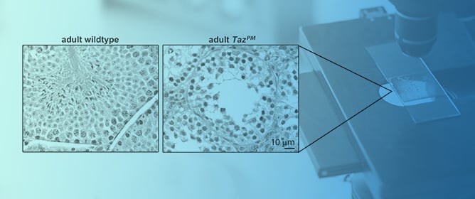 The Loss of Tafazzin Transacetylase Activity Is Sufficient to Drive Testicular Infertility