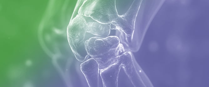 Genetics and Molecular Pathogenesis of the Chondrosarcoma: A Review of the Literature