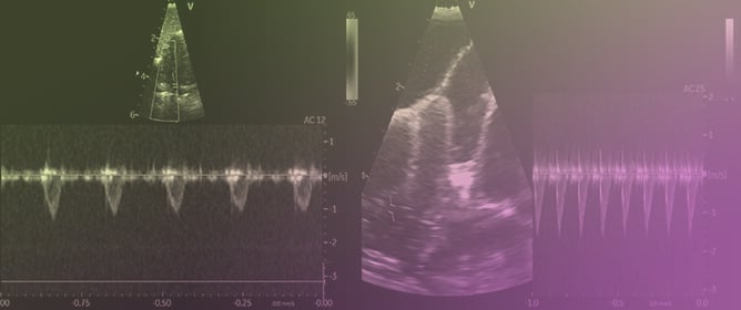 Shape of the Doppler Sonographic Systolic Blood Flow Profile of the Pulmonary Artery of Healthy Racing Pigeons and the Influence of Anesthesia