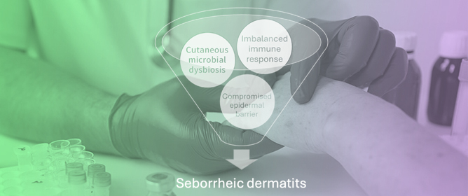 Seborrheic Dermatitis: From Microbiome and Skin Barrier Involvement to Emerging Approaches in Dermocosmetic Treatment