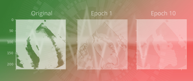 Unsupervised Image Segmentation on 2D Echocardiogram