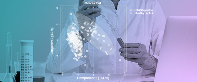 Detection and Validation of Organic Metabolites in Urine for Clear Cell Renal Cell Carcinoma Diagnosis