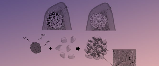 Migration Prevention of Carbonate Apatite Granules Through Crystal Interlocking Driven by Bassanite-to-Gypsum Transformation on Granule Surface