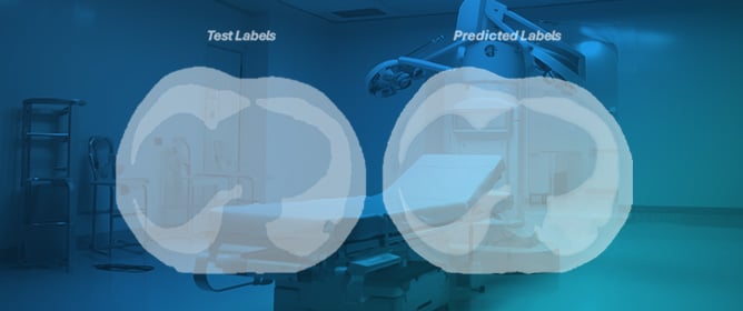 Implementation of Automatic Segmentation Framework as Preprocessing Step for Radiomics Analysis of Lung Anatomical Districts