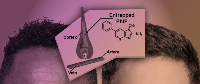 Biomonitoring PhIP, a Potential Prostatic Carcinogen, in the Hair of Healthy Men of African and European Ancestry