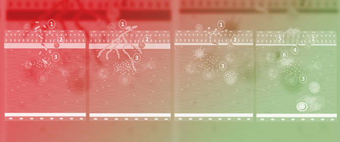 Drug Delivery Systems for Infectious Eye Diseases