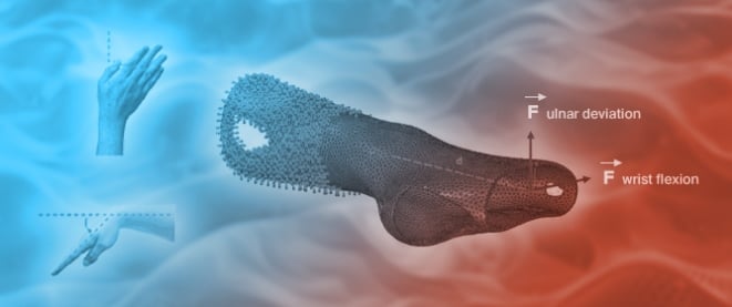 Topological Optimisation of 3D-Printed Customised Orthopaedic Devices