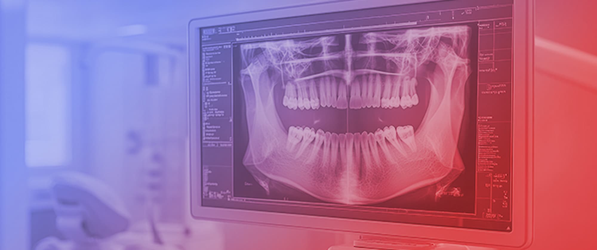 Deep Learning to Estimate Age and Sex from Panoramic Radiographs