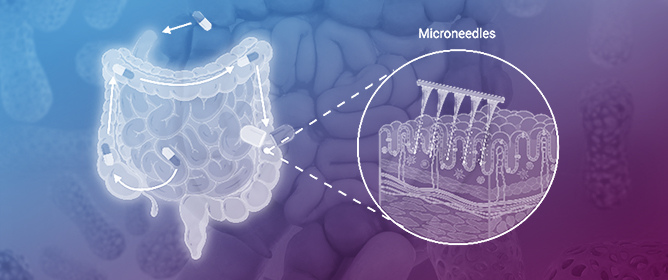 Advancing Inflammatory Bowel Disease Treatment by Targeting the Innate Immune System and Precision Drug Delivery