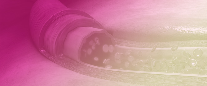 Plasma Parathormone Levels during Citrate Anticoagulated Continuous Venovenous Hemofiltration in ICU Patients