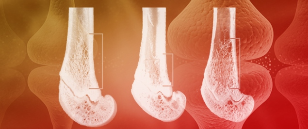 Effects of Vector Potential Generators on Bone