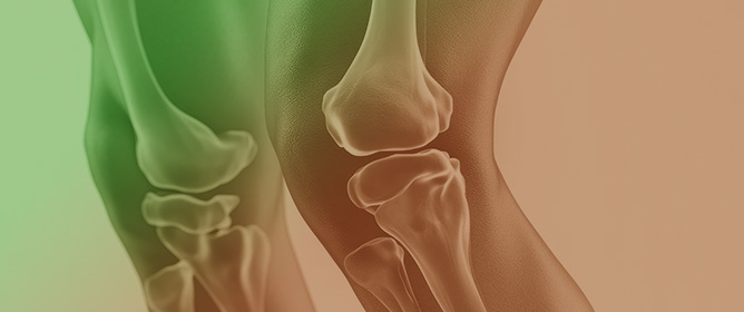 Evaluation of the Timed Up and Go Test in Patients with Knee Osteoarthritis Using Inertial Sensors