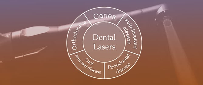 Advanced Lasers and Their Applications in Dentistry