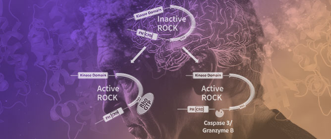 RhoA/ROCK/GSK3&beta; Signaling: A Keystone in Understanding Alzheimer&rsquo;s Disease