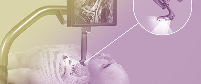 Not All SAVR Are Created Equal: All the Approaches Available for Surgical Aortic Valve Replacement