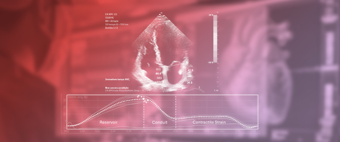 Linking Epicardial Adipose Tissue to Atrial Remodeling: Clinical Implications of Strain Imaging