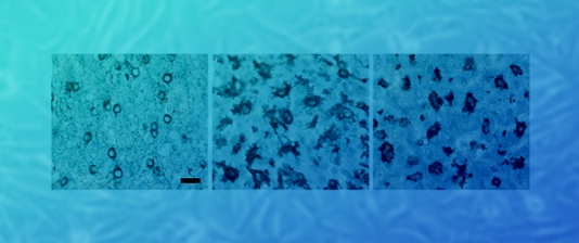 Microglia-Derived Brain Macrophages Associate with Glioblastoma Stem Cells: A Potential Mechanism for Tumor Progression Revealed by AI-Assisted Analysis