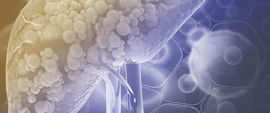 Drug Pipeline for MASLD: What Can Be Learned from the Successful Story of Resmetirom