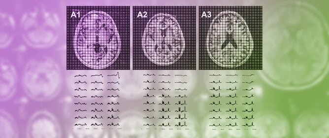 Fast Hadamard-Encoded 7T Spectroscopic Imaging of Human Brain