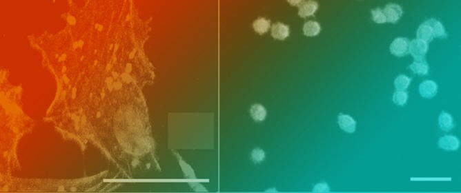 Concentration-Dependent Pleiotropic Effects of Thymosin Beta4 and Cofilin on the Migratory Activity of Carcinoma Cells