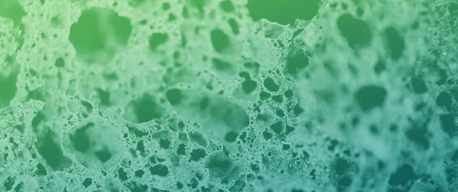 Higher Rates of Psoriatic Arthritis in Patients with Calcium Pyrophosphate Deposition Disease than in Controls: A Retrospective Cohort Study