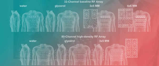 3D Metamaterials Facilitate Human Cardiac MRI at 21.0 Tesla