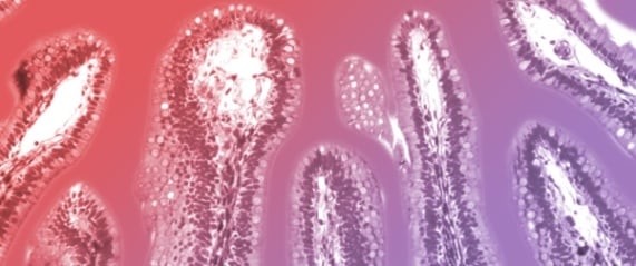 The Intestinal Stem Cell Niche: Generation and Utilization of Intestinal Organoids