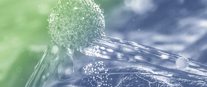 Molecular Characterization of Atypical Fibroxanthoma and Pleomorphic Dermal Sarcoma