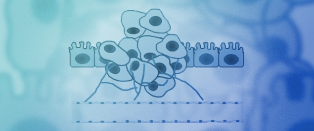 Inflammation and Cancer: From Initiation to Metastasis