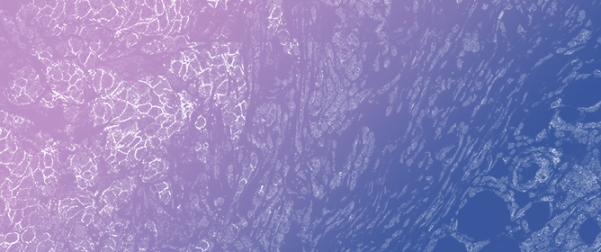 ADAM Proteases in Cancer: Biological Roles, Therapeutic Challenges, and Emerging Opportunities