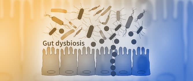 Gut Microbiome and Metabolite Shifts During Obesity
