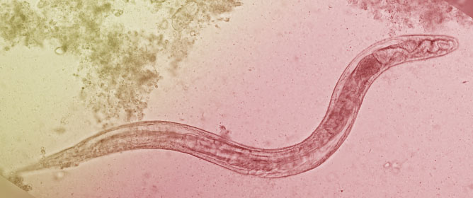 Schistosomiasis and Soil Transmitted Helminthiasis Among School Age Children: Impact of 3&ndash;5 Annual Rounds of Mass Drug Administration in Ekiti State, Southwest Nigeria
