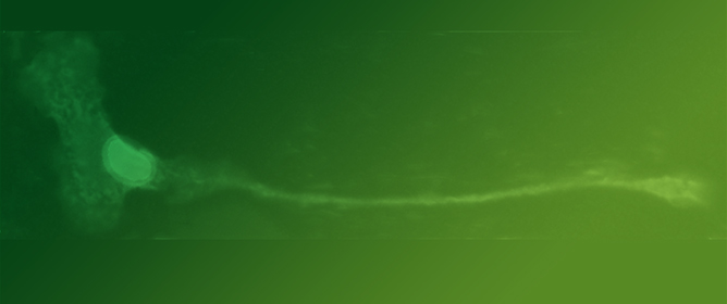 Mechanical Forces, Nucleus, Chromosomes, and Chromatin