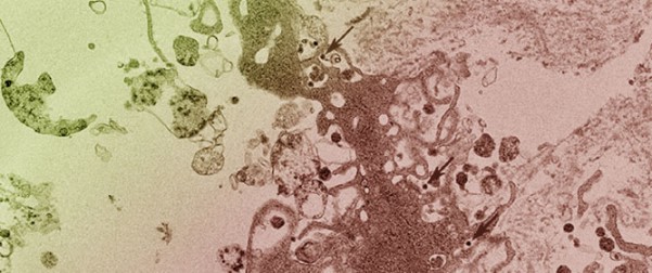 Novel Orthomyxovirus from a <em>Bothriocroton hydrosauri</em> Tick