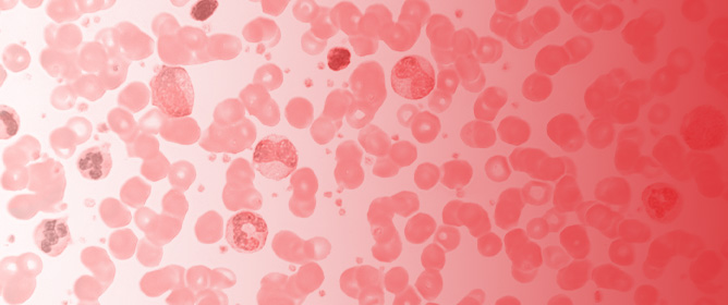 The Role of Ferritin and Folate in Determining Stem Cell Collection for Autologous Stem Cell Transplant in Multiple Myeloma