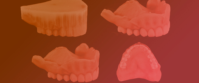 Color Stability, Gloss, Surface Roughness, and Wettability of Material Jetting 3D-Printed Denture