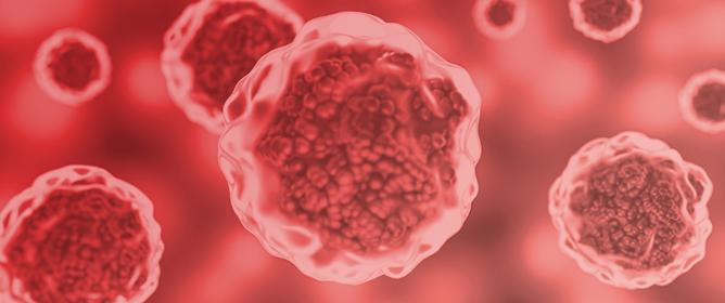 Current Therapies and Potential Strategies for Uveal Melanoma